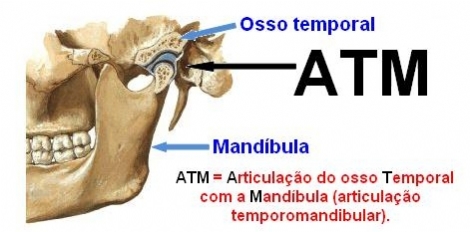 ATM E SUA DISFUNÇÃO. CAUSA IMPORTANTE DA DOR CRÔNICA NA PARTE